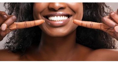 What Should I Do After the Teeth Whitening Procedure to Maintain Results