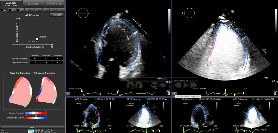 Cardiac Imaging