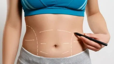 Best Liposuction