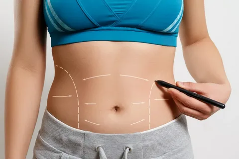 Best Liposuction